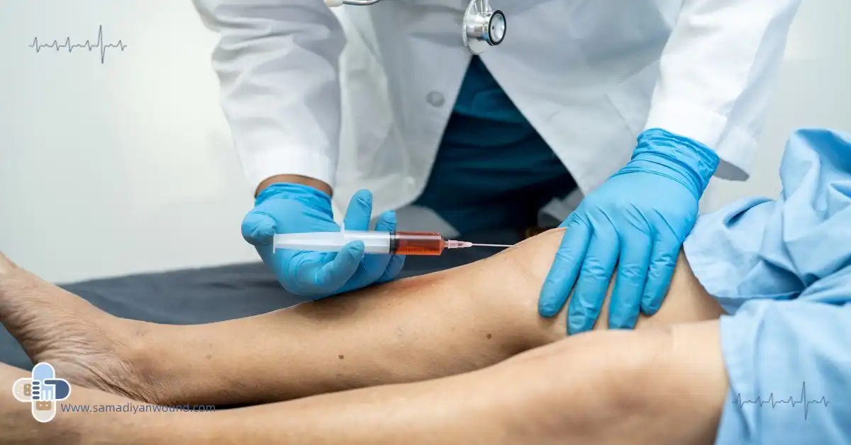 فرآیند تزریق پی آر پی