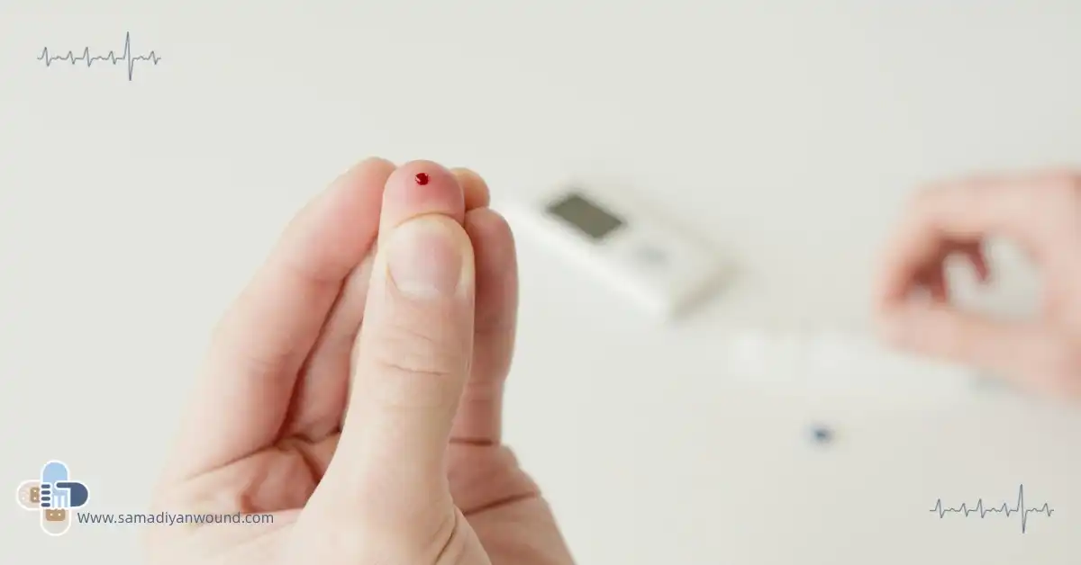 درمان زخم پای دیابتی