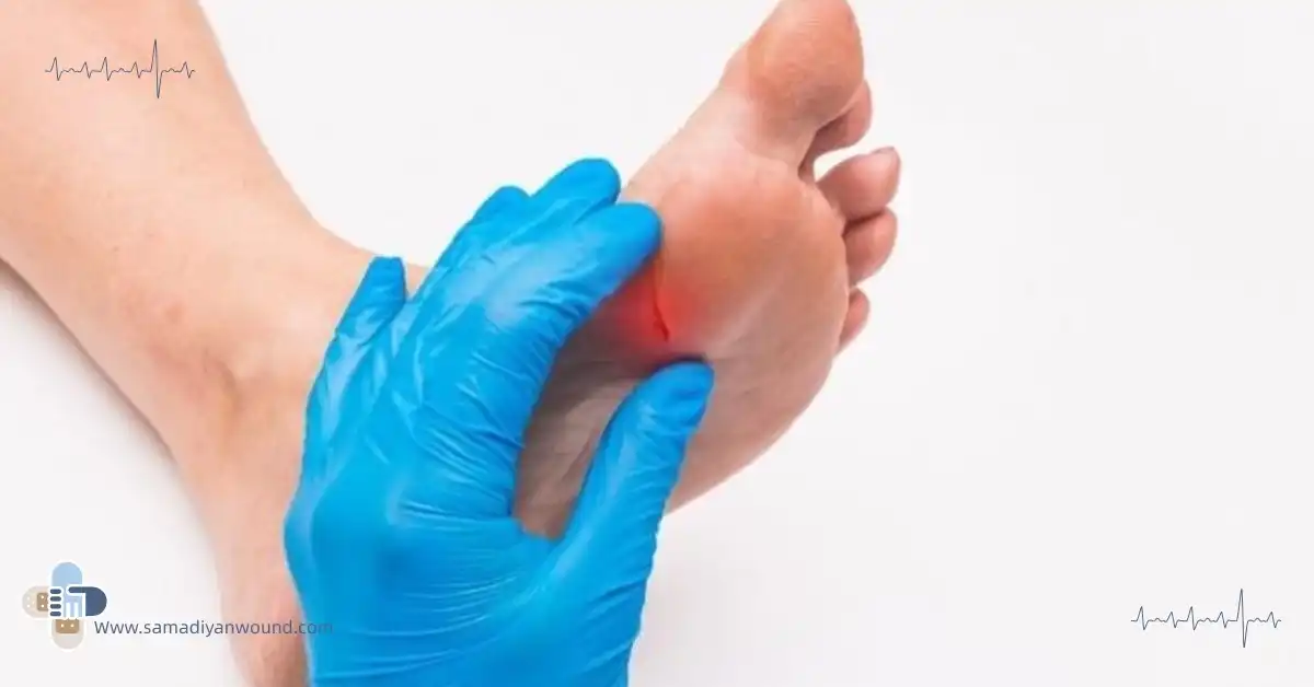 آسیب به پای بیماران دیابتی