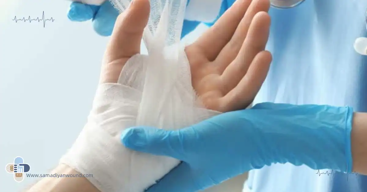 پانسمان دست سوخته