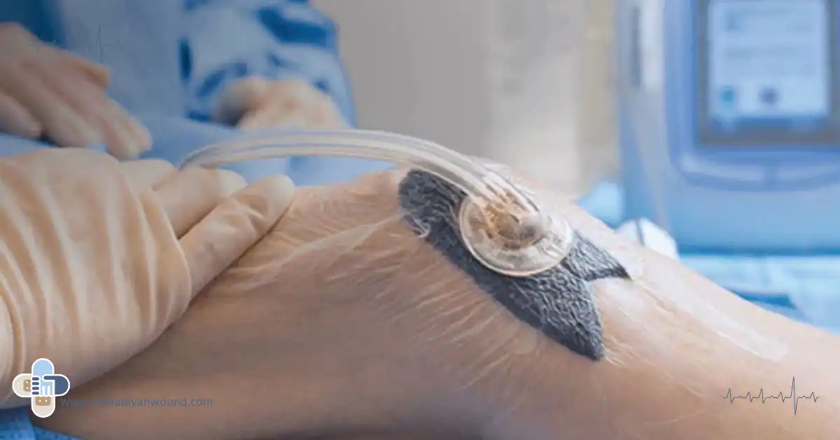 وکیوم تراپی