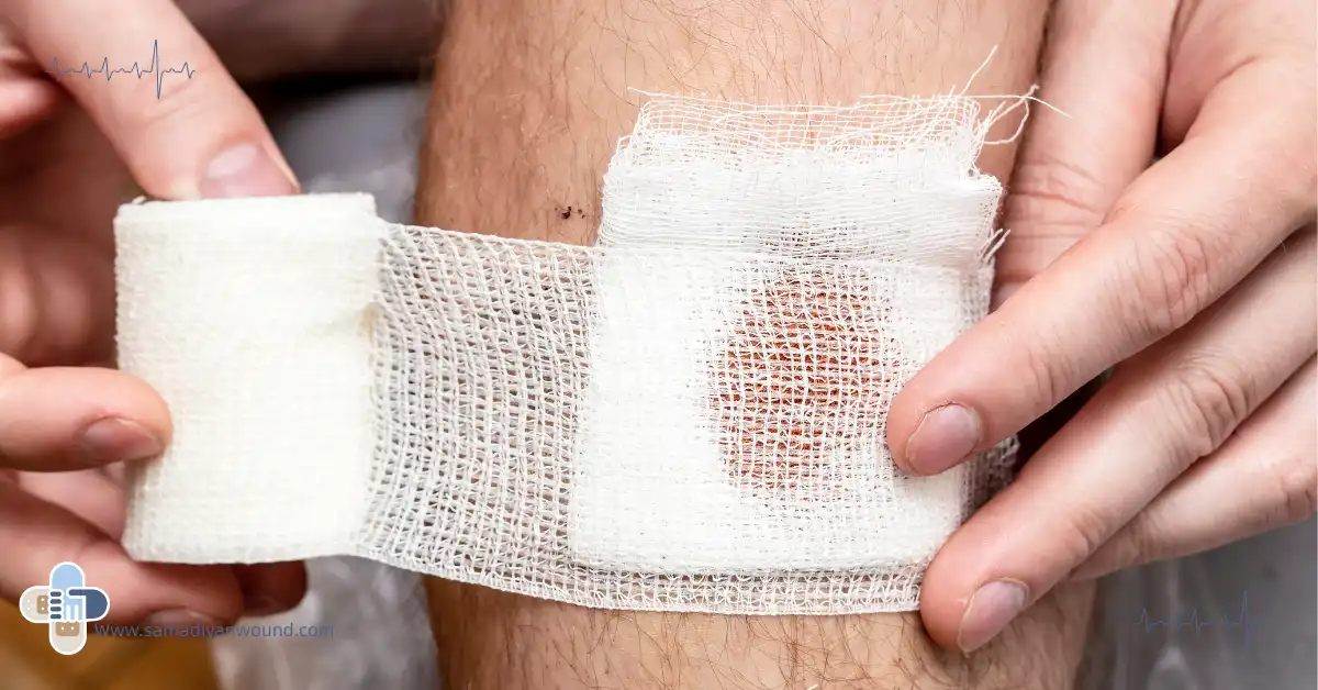 پانسمان زخم باز