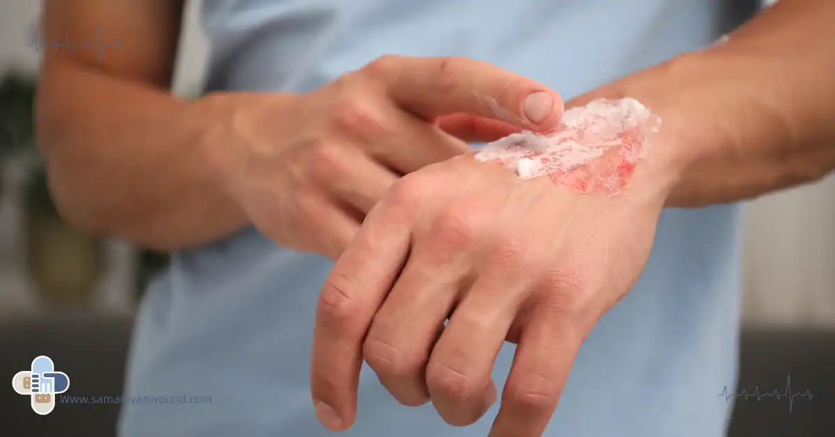 پماد درمانی