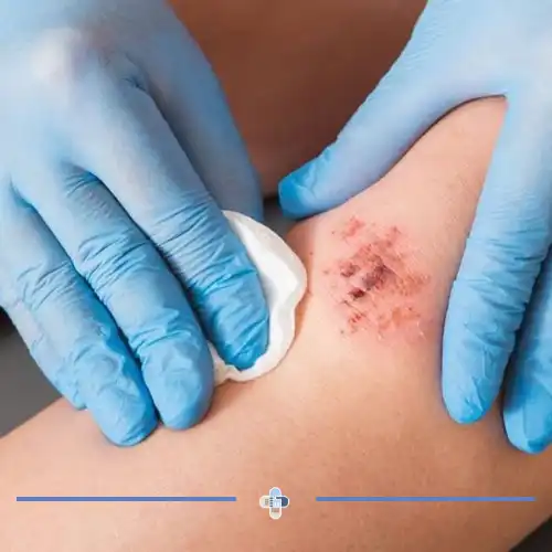 ارزیابی دقیق زخم