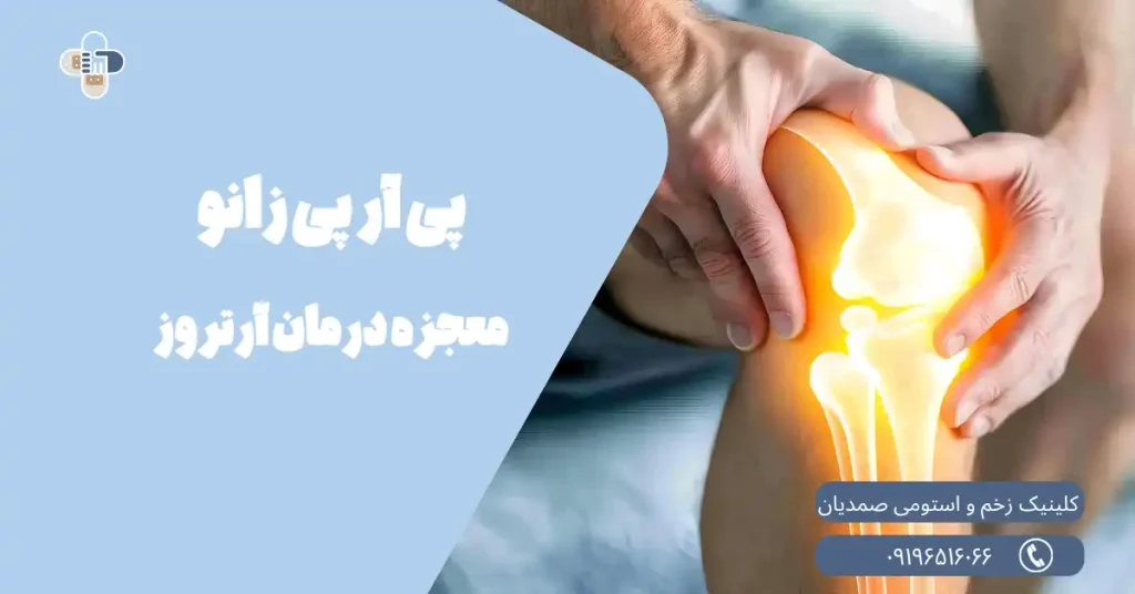 پی آر پی زانو