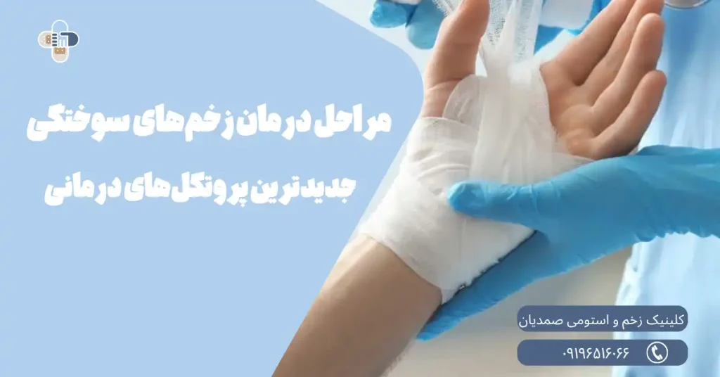 درمان زخم‌های سوختگی