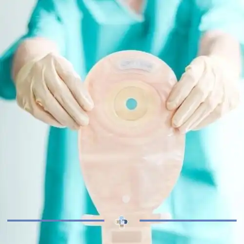 درمان زخم های استومی