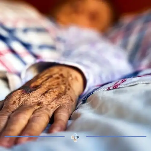 زخم بستر سالمندان