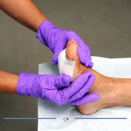 پانسمان زخم پای دیابتی