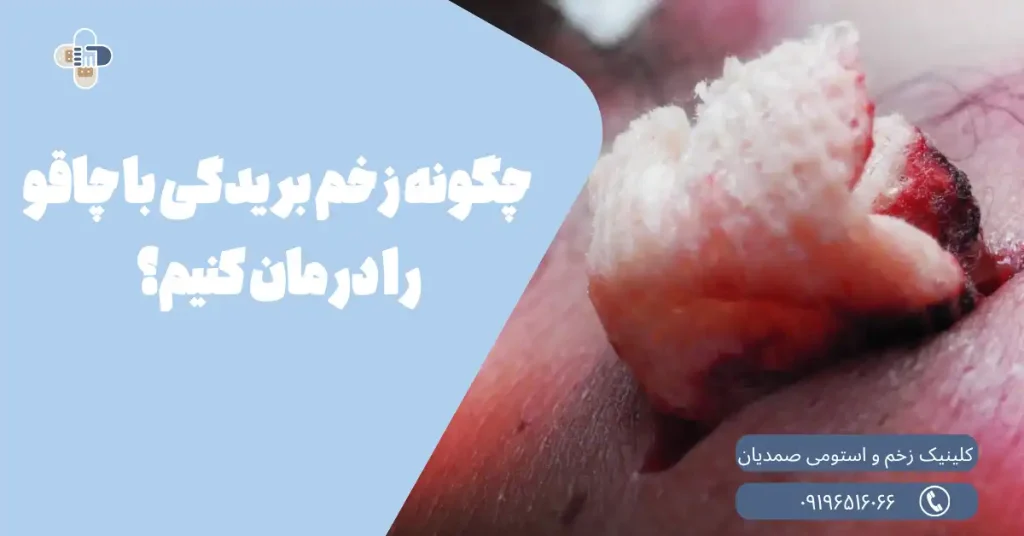 درمان زخم چاقو