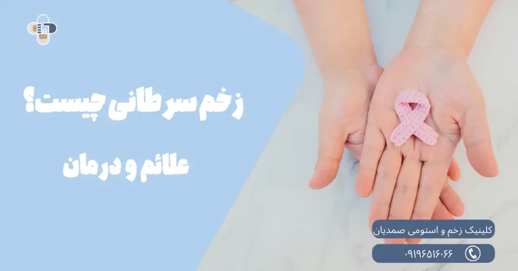 درمان زخم های سرطانی