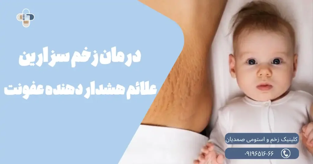 درمان زخم سزارین