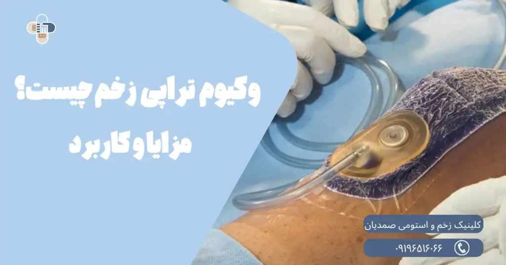 وکیوم تراپی زخم