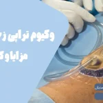 وکیوم تراپی زخم