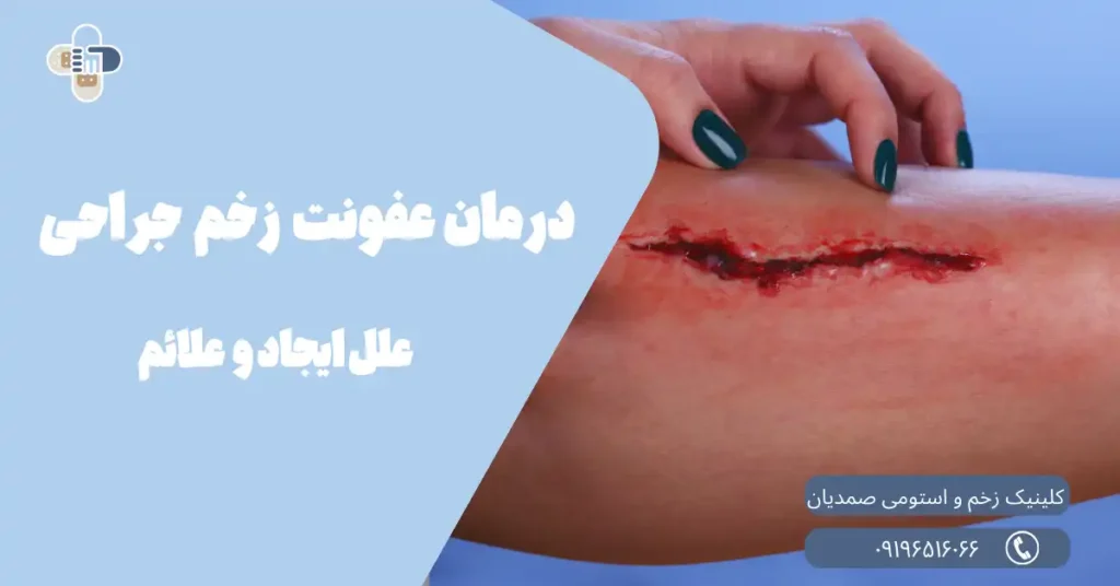 عفونت زخم جراحی