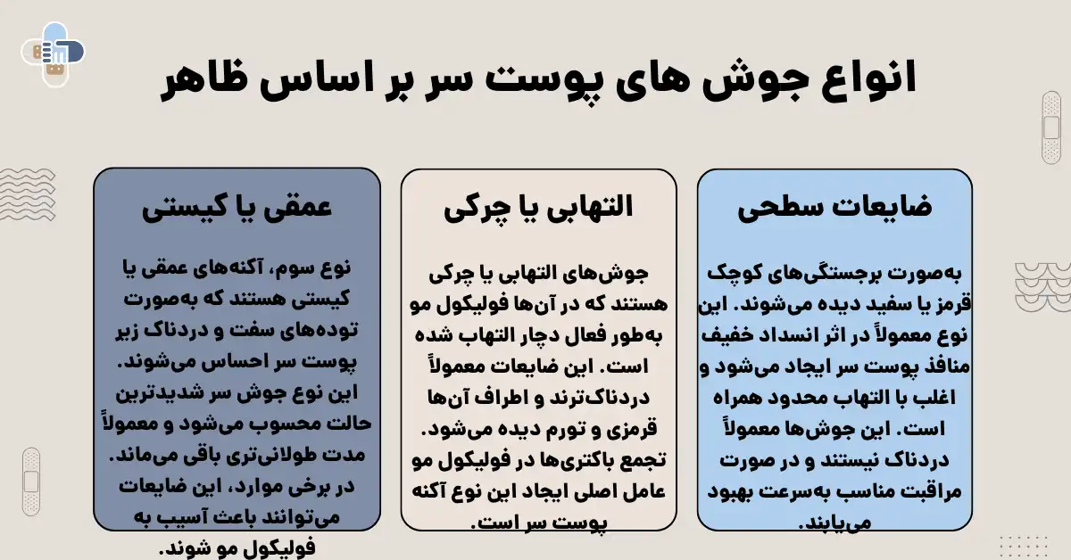 انواع جوش